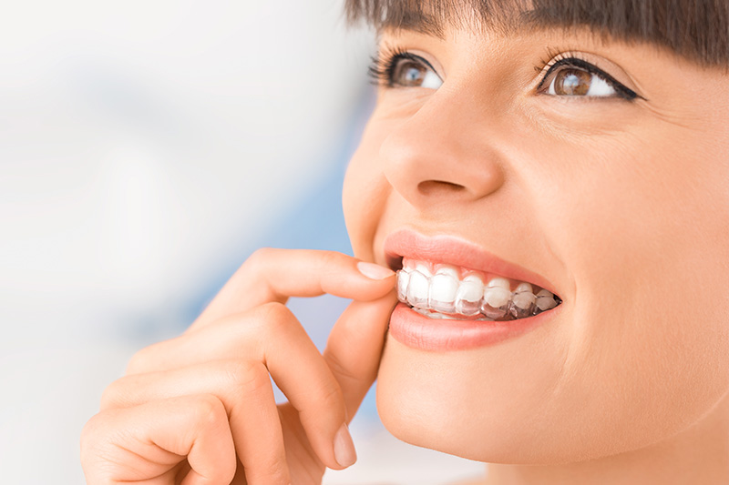 Invisalign in Morgan Hill