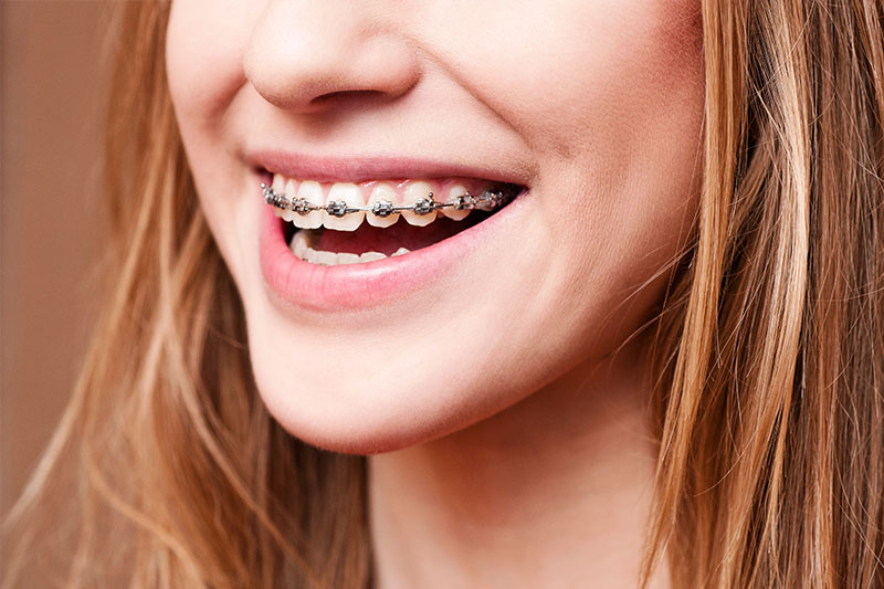 Orthodontics in Morgan Hill