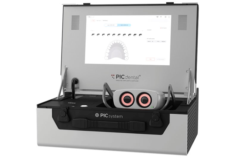 Implants Oral Scanner in 